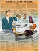 Плакат "Алкогольная зависимость" ламинированный - fgospostavki.ru - Нижний Тагил