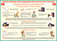 Таблица "Порядок действий при опасном кровотечении" (100х140 сантиметров, винил) - fgospostavki.ru - Нижний Тагил